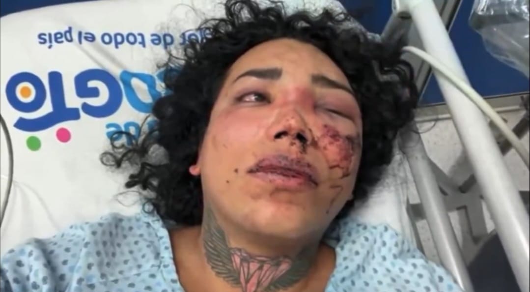 nxnoticias.com-propinan-golpiza-a-integrante-de-las-perdidas