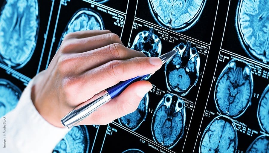 nxnoticias.com-reporta-unam-aumento-del-alzheimer-senala-que-el-envejecimiento-no-es-la-unica-causa