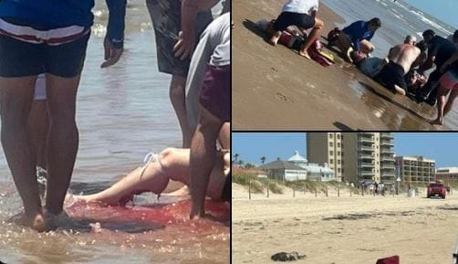 nxnoticias.com-tiburon-ataca-a-pareja-en-isla-del-padre-en-texas-los-reportan-graves
