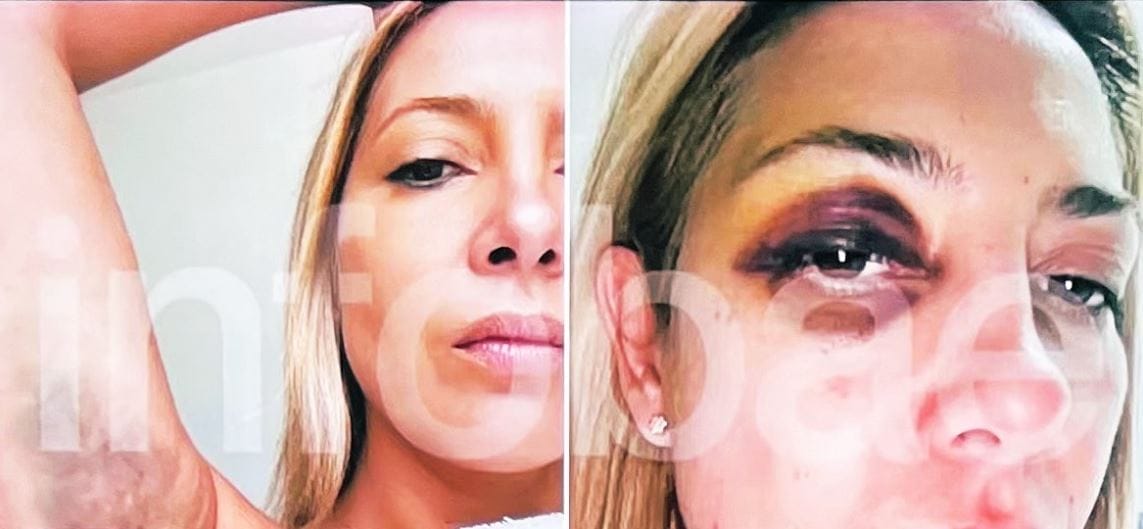 nxnoticias.com-acusan-a-expresidente-de-argentina-por-lesiones-contra-exprimera-dama