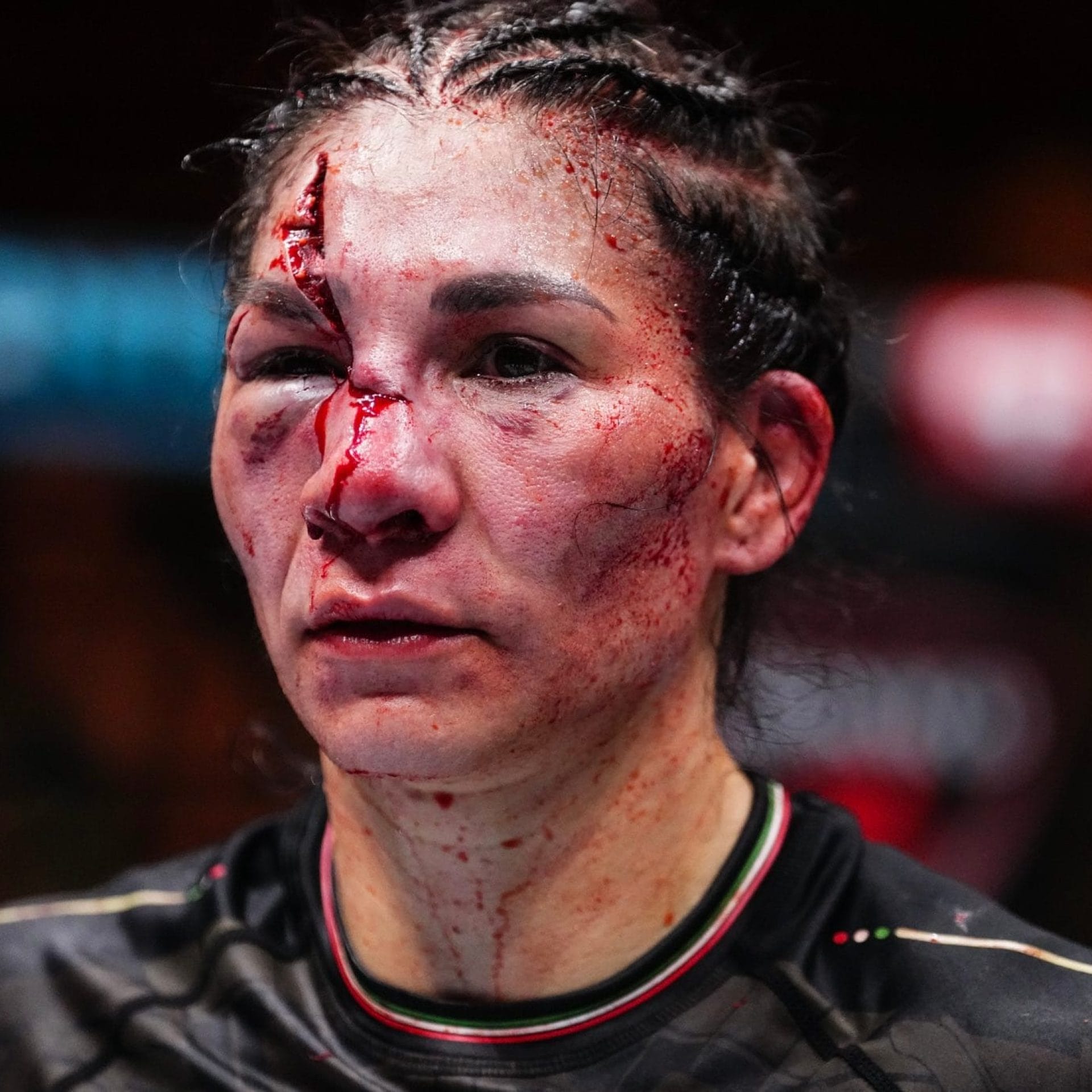 nxnoticias.com-irene-aldana-rostro-desfigurado-tras-espeluznante-corte-en-la-ufc