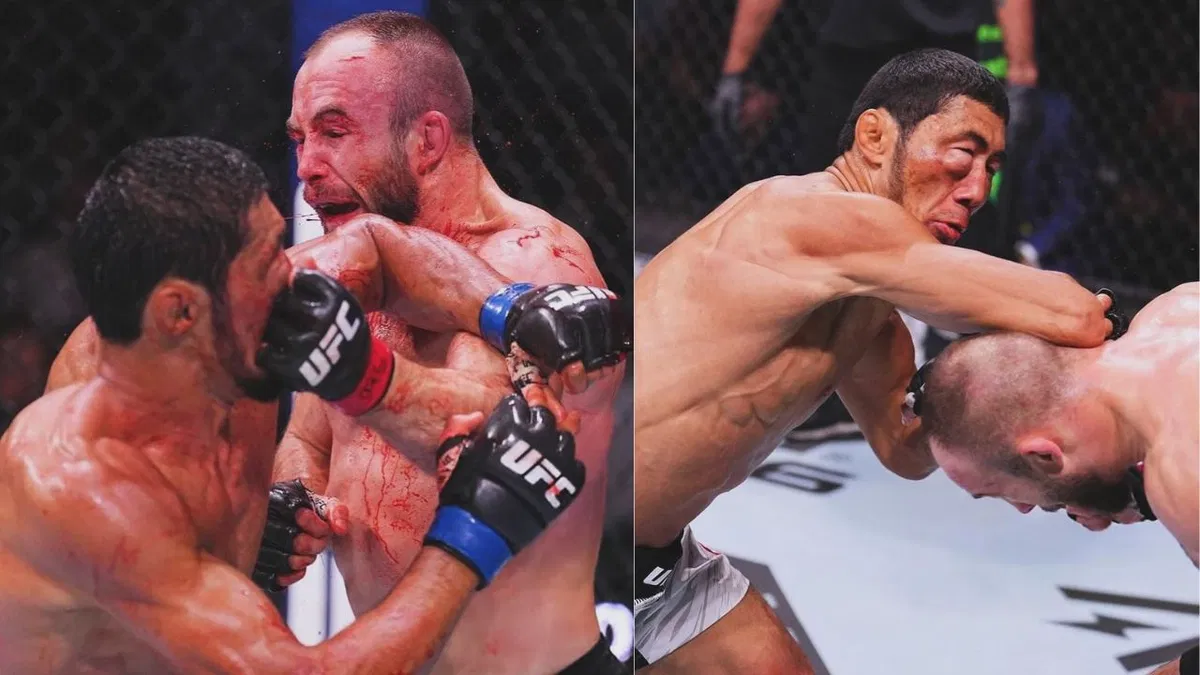 nxnoticias.com-impactante-rostro-de-myktybek-orolba-tras-pelea-con-rebecki-en-ufc-308
