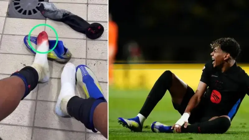 nxnoticias.com-impactante-imagen-de-lamine-yamal-con-su-pie-ensangrentado-tras-la-victoria